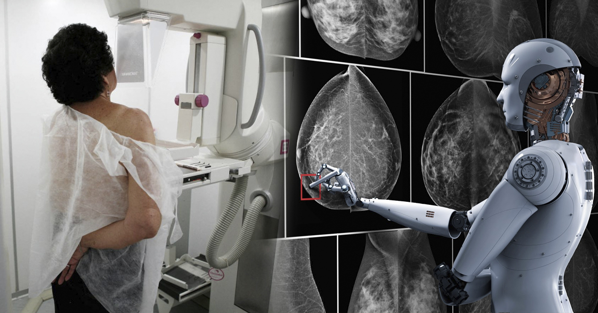 CREAN IA CON CAPACIDAD DE DETECTAR TIPOS DE CÁNCER DIFÍCILES DE UBICAR