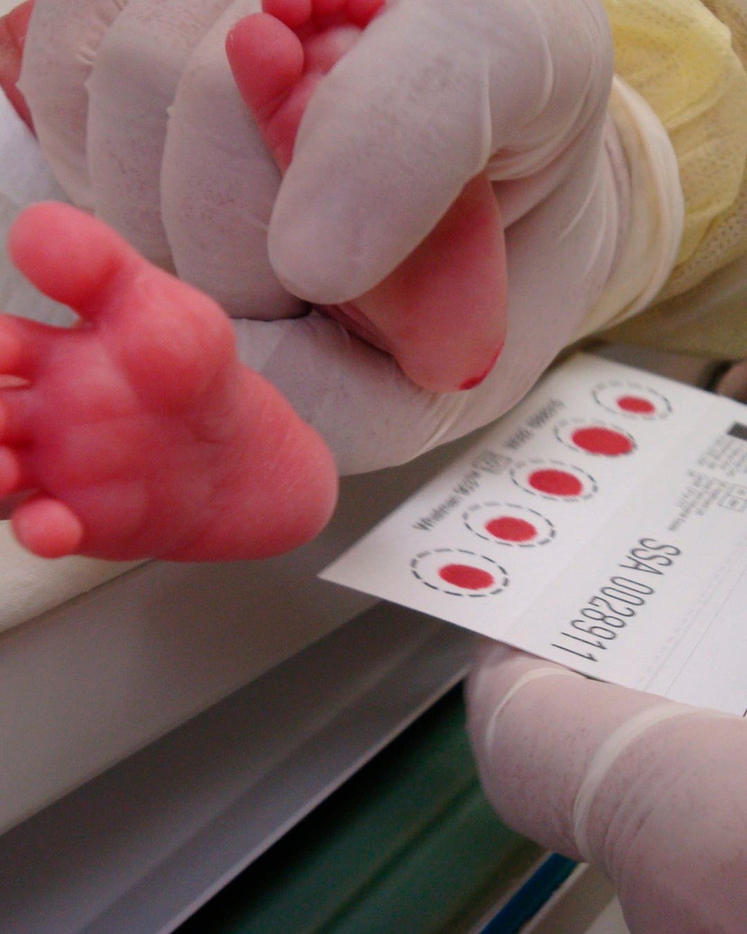 El tamiz neonatal permite detectar hasta 43 enfermedades metabólicas y congénitas en recién nacidos de San Luis Potosí