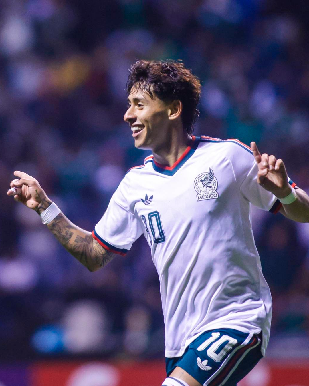 Santiago Sandoval queda fuera del Premundial Sub-20 tras sufrir una severa fractura en la mano derecha